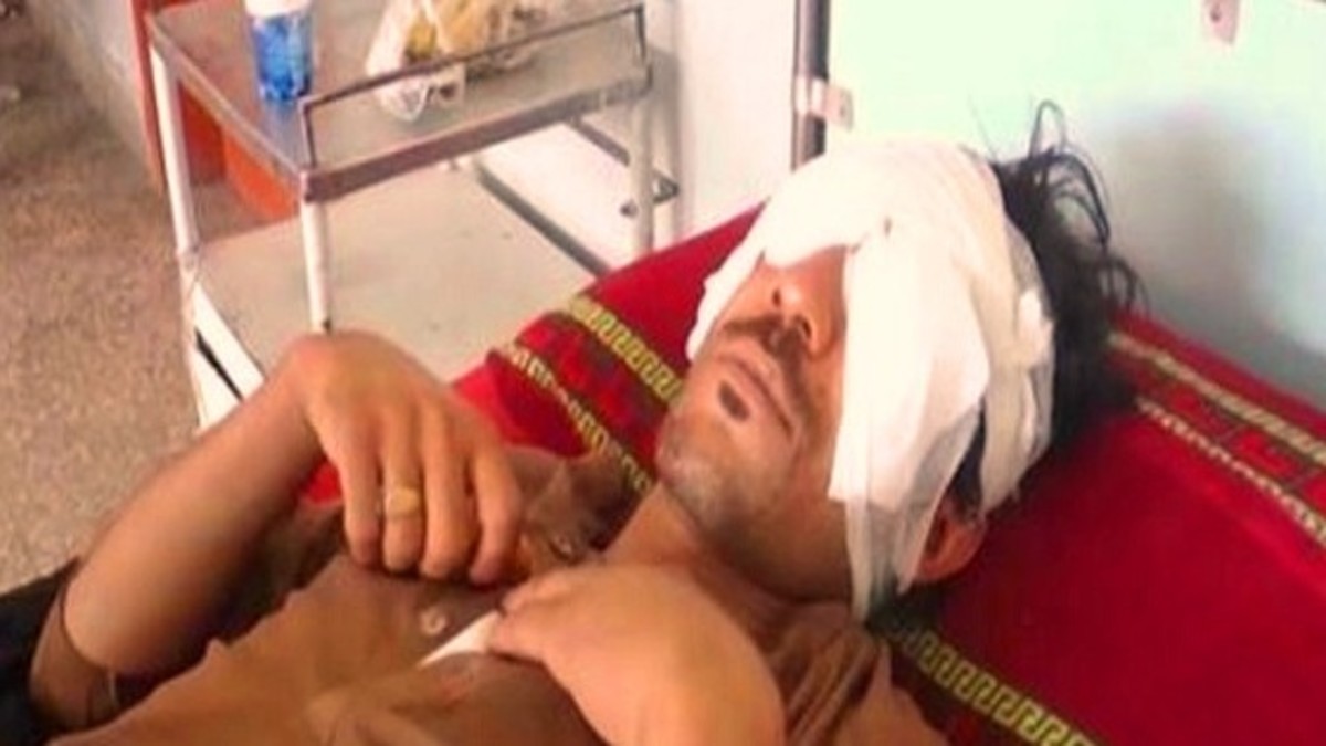 عبد الباقي راقد مفقوء العينين في المستشفى بكراتشي
